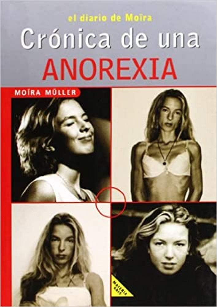 Portada de CRONICA DE UNA ANOREXIA
